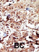 PAB3311 - PCK2