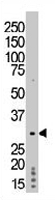 PAB3315 - TP53RK