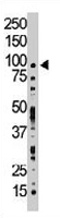 PAB3318 - TLK1