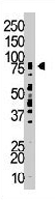 PAB3319 - TLK2