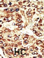PAB3321 - WEE1 / Wee1-like protein kinase