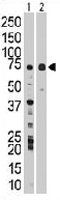 PAB3322 - WEE1 / Wee1-like protein kinase