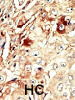 PAB3322 - WEE1 / Wee1-like protein kinase