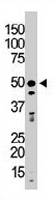 PAB3336 - GSK3 beta