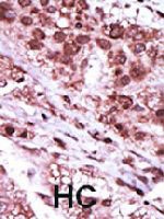 PAB3336 - GSK3 beta