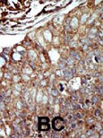 PAB3339 - DAG kinase theta