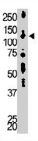 PAB3346 - DAG kinase delta
