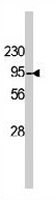 PAB3348 - DAG kinase beta