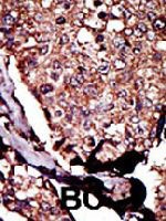 PAB3348 - DAG kinase beta