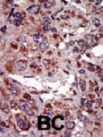 PAB3350 - DAG kinase alpha
