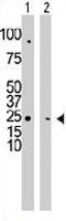 PAB3352 - CMPK1