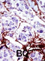 PAB3352 - CMPK1