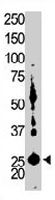 PAB3354 - Adenylate kinase 5 / AK5