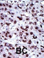 PAB3354 - Adenylate kinase 5 / AK5