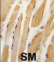 PAB3355 - Integrin-linked protein kinase
