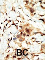 PAB3356 - CD220 / INSR