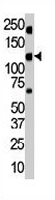 PAB3357 - INSRR / IRR