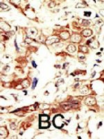 PAB3358 - INSRR / IRR
