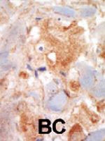 PAB3359 - CD117 / c-kit