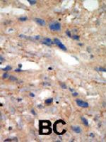 PAB3360 - CD117 / c-kit