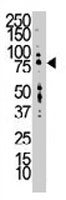 PAB3361 - LTK / TYK1