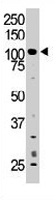 PAB3367 - MERTK