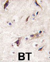 PAB3367 - MERTK