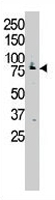 PAB3370 - MUSK