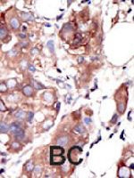 PAB3370 - MUSK