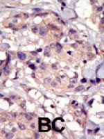 PAB3372 - CD140a / PDGFRA