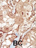 PAB3375 - CD140b / PDGFRB