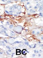 PAB3378 - CD140b / PDGFRB