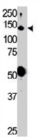 PAB3379 - RET