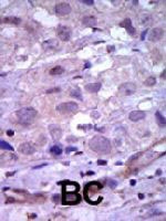 PAB3379 - RET