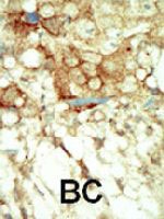 PAB3382 - RET