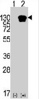 PAB3384 - ROR1