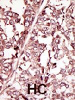 PAB3387 - ROS1