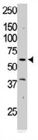 PAB3388 - Tyrosine-protein kinase RYK