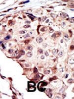 PAB3388 - Tyrosine-protein kinase RYK
