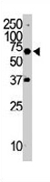 PAB3389 - Tyrosine-protein kinase RYK