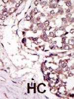 PAB3389 - Tyrosine-protein kinase RYK