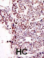PAB3391 - TYRO3