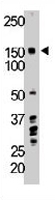 PAB3397 - TIE1