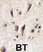 PAB3397 - TIE1