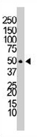 PAB3405 - DOK1 / p62 dok