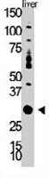 PAB3409 - DOK5
