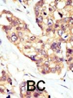 PAB3409 - DOK5