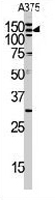 PAB3413 - ABL1