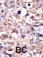 PAB3413 - ABL1