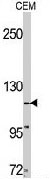 PAB3416 - TNK2 / ACK1